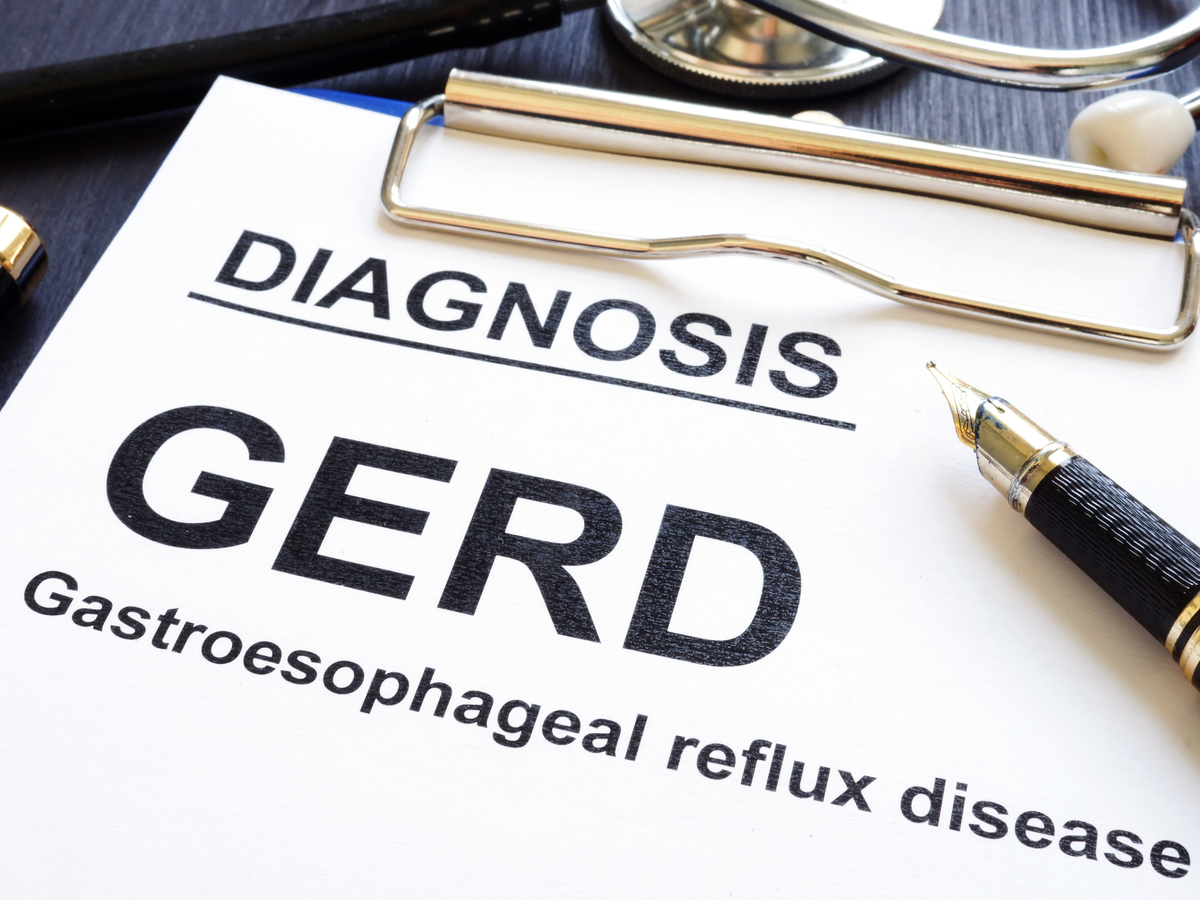 GERD Diet: What to Eat and What to Avoid for Acid Reflux